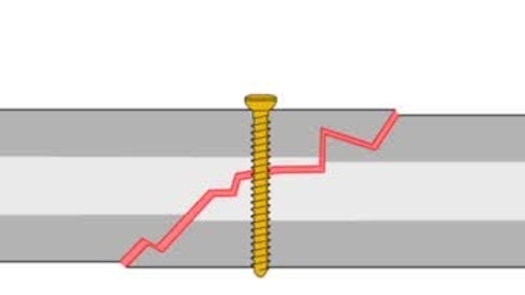 Thumbnail for entry Positional screw technique