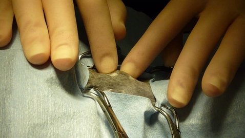 Thumbnail for Thyroid palpation