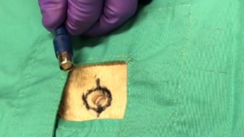Thumbnail for Performing a punch skin biopsy