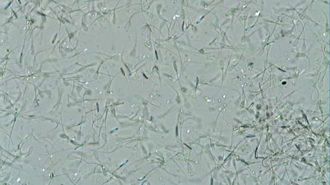 Thumbnail for Semen motility: Clip 2