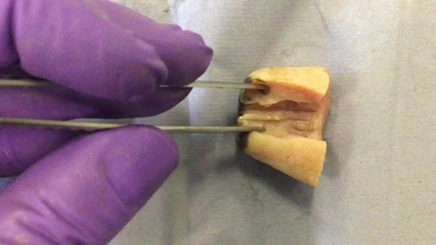 Thumbnail for Cow teat anatomy: Clip 1