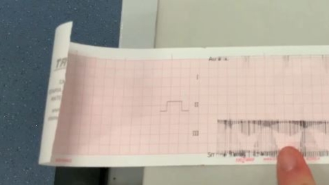 Thumbnail for entry Recording an electrocardiogram in the dog