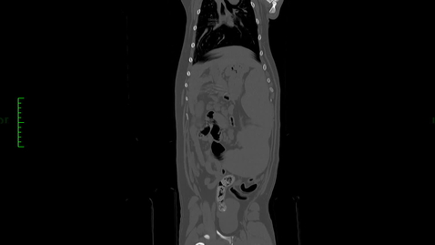 Thumbnail for CT scan of canine: Session 1 (DV view)