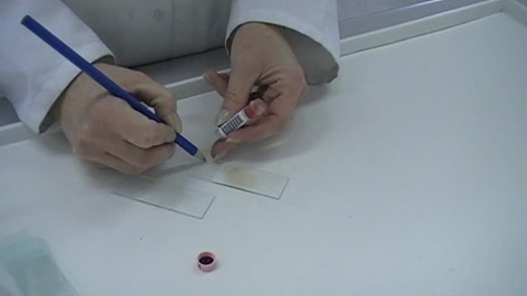 Thumbnail for entry How to make a good blood smear