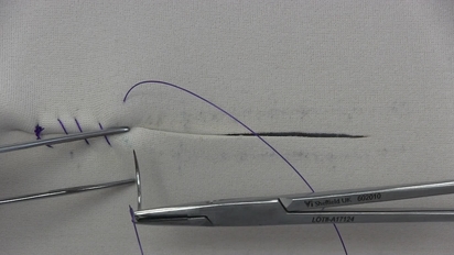 Lembert suture pattern MediaSpace University of Nottingham