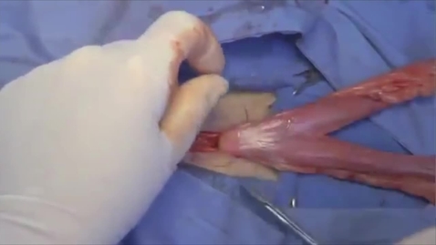 Thumbnail for Ovariohysterectomy in the bitch: Ligation of the uterus