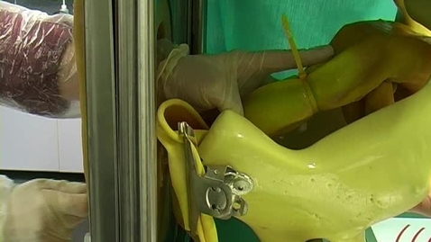 Thumbnail for Administering intrauterine antibiotic treatment