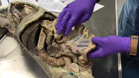 Thumbnail for Anatomy of the gastrointestinal tract: Mesentry