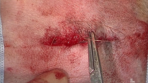 Thumbnail for Closed castration and scrotal ablation in the dog