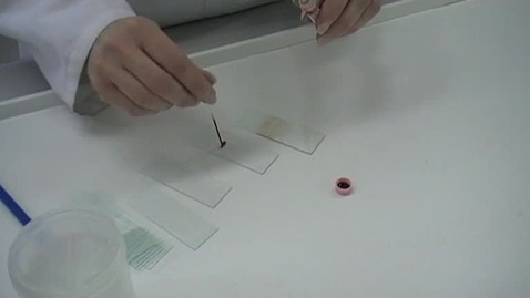 Thumbnail for entry How to make a bad blood smear