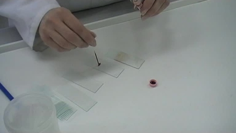 Thumbnail for How to make a bad blood smear