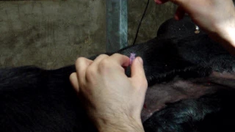 Thumbnail for Performing a paravertebral block at T13