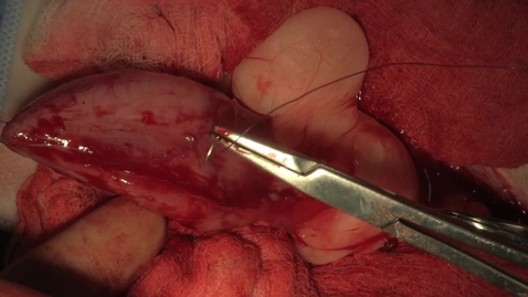 Thumbnail for Ventral cystotomy in the bitch