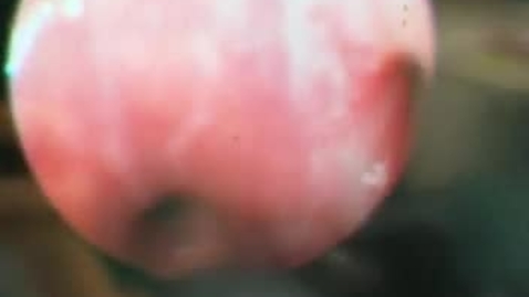 Thumbnail for Fibreoptic bronchoscopy in the dog