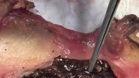 Thumbnail for Reproductive tract in the ewe