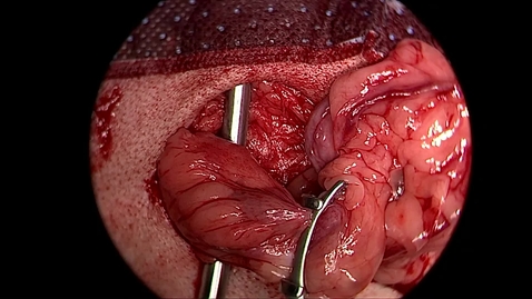 Thumbnail for Ovariohysterectomy in the bitch: Use of a Hauptman retractor