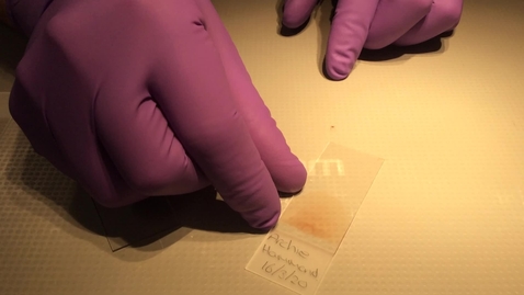 Thumbnail for Preparing a blood smear