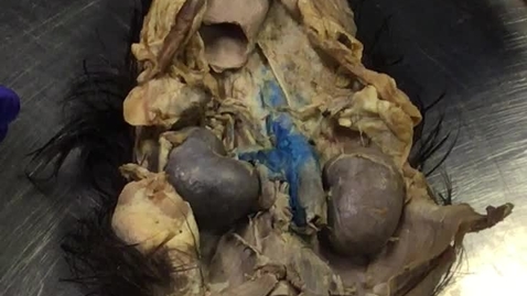 Thumbnail for Reproductive tract in the bitch in-situ: Clip 2