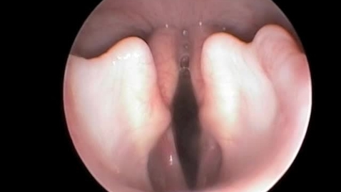 Thumbnail for Laryngoscopy in the shih tzu