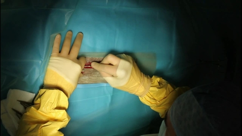 Thumbnail for Colic surgery