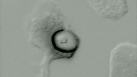 Thumbnail for Cell biology: Oxidative burst