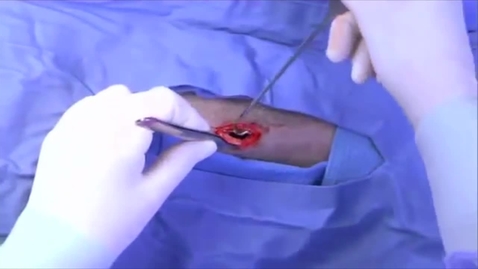 Thumbnail for Ovariohysterectomy in the bitch: Locating the uterus