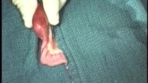 Thumbnail for entry Removing a foreign body from the small intestine in the cat