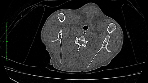 Thumbnail for CT scan of canine: Session 1 (Transverse view)