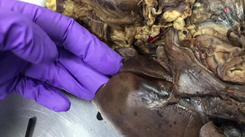 Thumbnail for Anatomy of the gastrointestinal tract in the dog: Liver - Clip 1