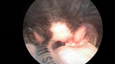 Thumbnail for Laryngoscopy showing stage II laryngeal collapse in the pug