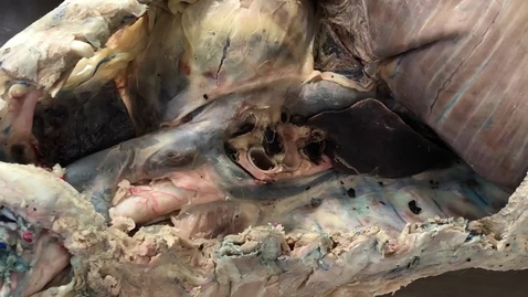 Thumbnail for Great vessels in the thorax