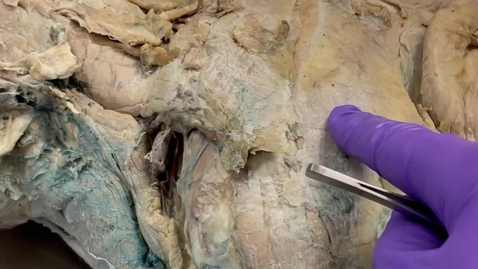 Thumbnail for Palpable lymph nodes in the dog