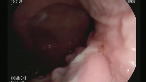 Thumbnail for Upper gastrointestinal endoscopy in the dog