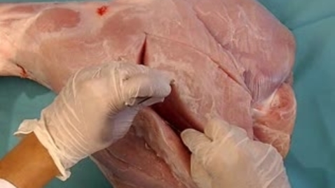 Thumbnail for Anatomical dissection techniques
