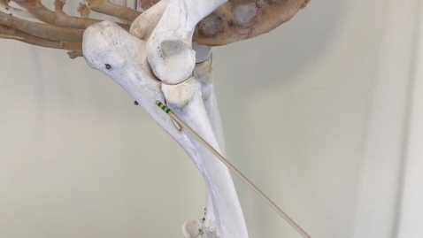 Thumbnail for Forelimb of the horse: Radius and ulna