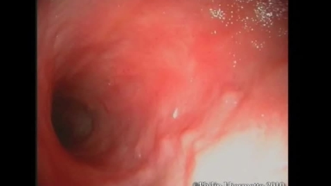 Thumbnail for Upper GI Imaging : Clip 7