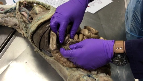 Thumbnail for Anatomy of the gastrointestinal tract in the dog: Caecum