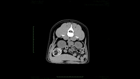 Thumbnail for entry Abdominal CT scan in the bitch