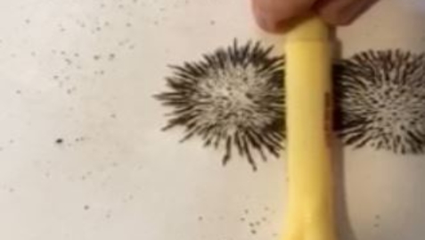 Thumbnail for Pulsed magnetic field therapy: Attraction magnetic field applicator
