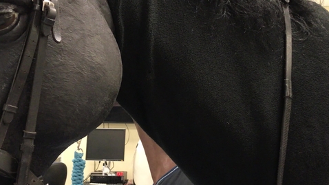 Thumbnail for IV catheter placement
