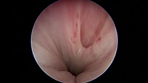 Thumbnail for Assessing the lower urogenital tract in the incontinent dog