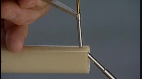 Thumbnail for Placing a positional screw to compress two pieces of bone in position