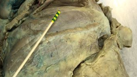 Thumbnail for Intrinsic forelimb muscles of the dog: Scapula