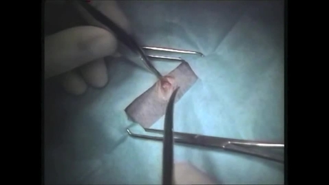 Thumbnail for Flank spay in the cat
