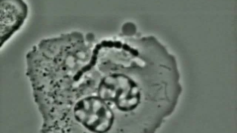 Thumbnail for Cell biology: Necrosis