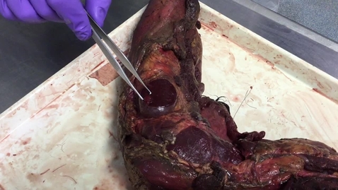 Thumbnail for Thyroid and parathyroid glands of the horse