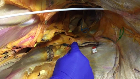 Thumbnail for Deep inguinal ring in the stallion