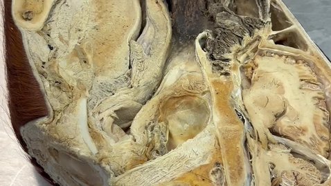Thumbnail for Anatomy of the nasal cavities of the horse
