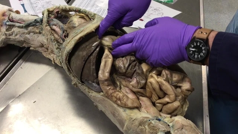 Thumbnail for Anatomy of the gastrointestinal tract in the dog: Duodenum