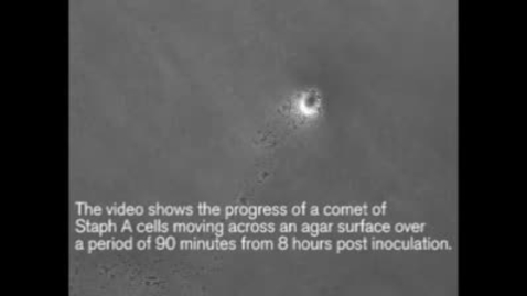 Thumbnail for Superbug colony behaviours revealed in time lapse video